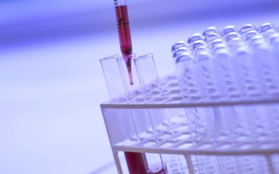 Détection de drogue au travail